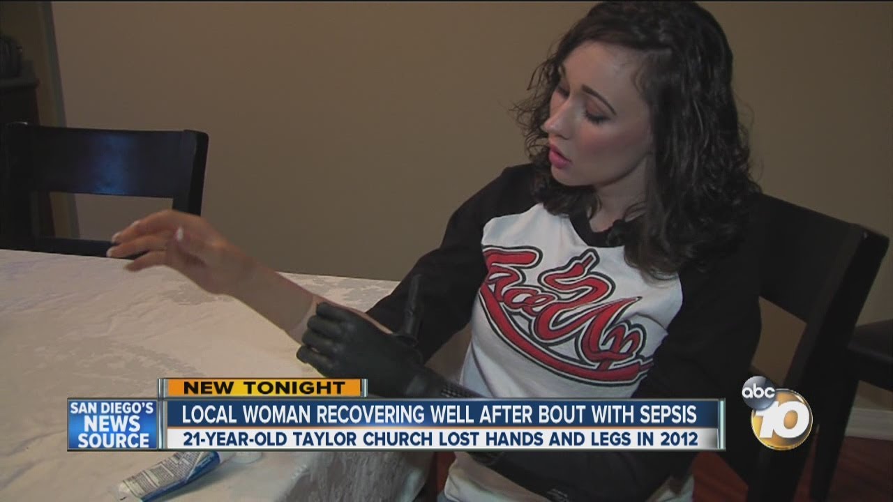 Escondido woman who survived sepsis speaks about ordeal