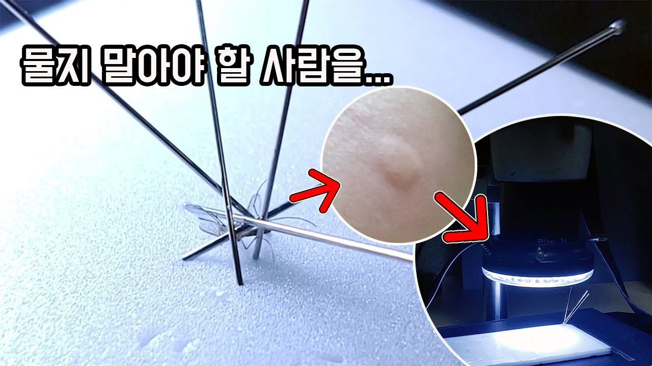 곤충 연구가의 집에 들어온 모기의 운명 (6방 물림)