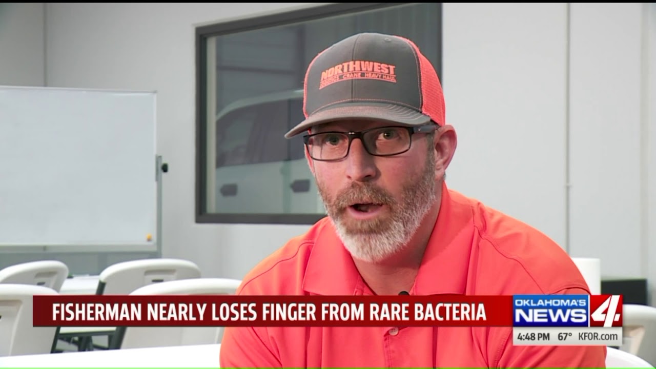 Fisherman almost loses finger to rare bacteria