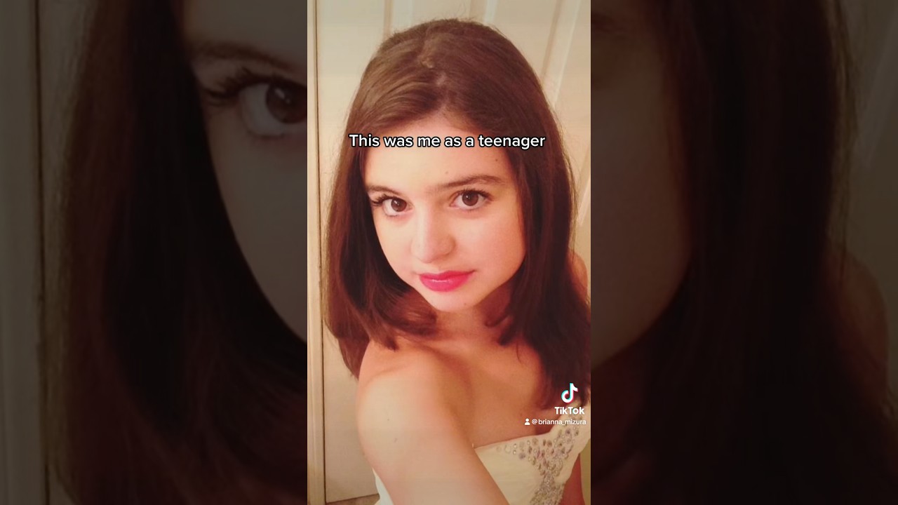 WHAT HAPPENED TO MY FACE?🥹#babyface #funny #teenager