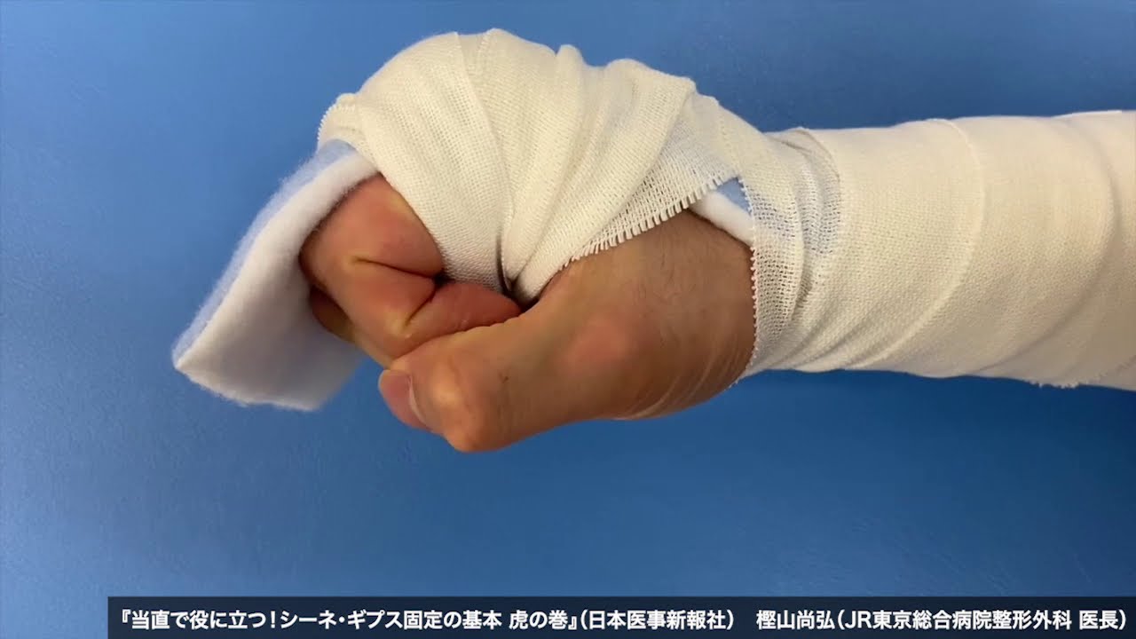 動画15「ナックルシーネ固定」