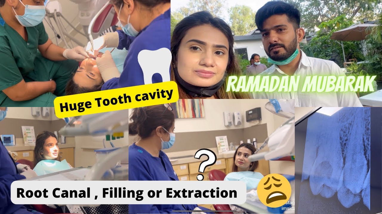 RAMADAN MUBARAK | I Am In Pain 😩HUGE TOOTH CAVITY | RCT, Filling or Extraction 😰