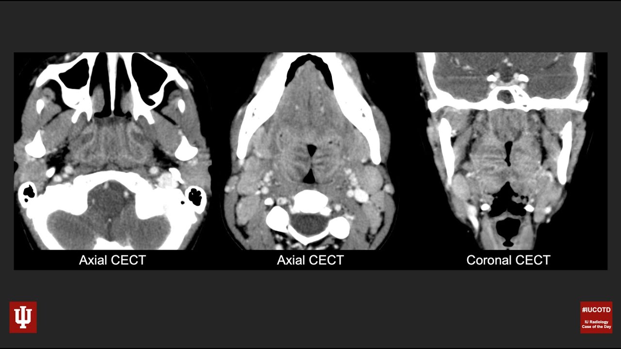 Случай заболевания головы и шеи дня № 79