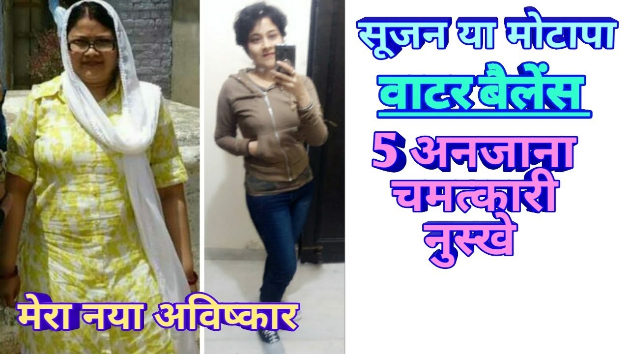 वाटर बैलेंस (सूजन और मोटापा ) काम  करने का 5 सरल तरीका जो आज तक आपने सूना नहीं होगा,  Dr Shalini