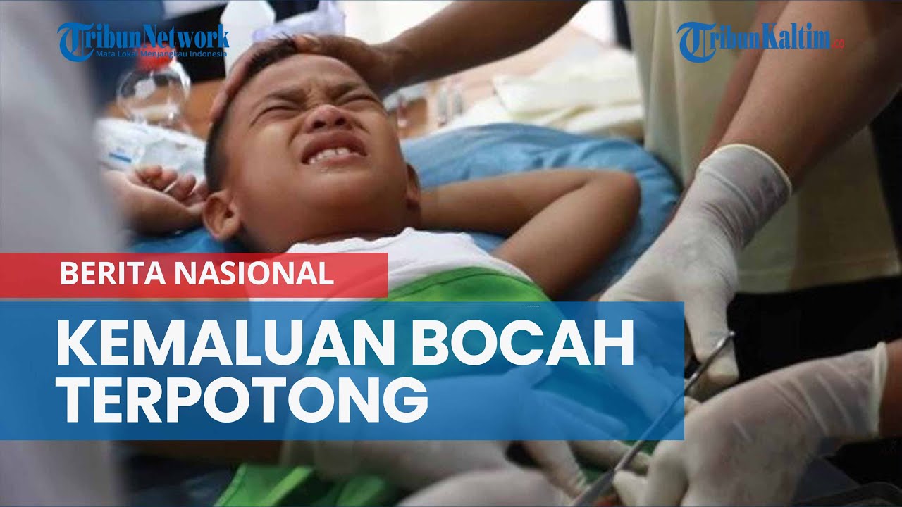 Kemaluan Bocah Terpotong Saat Sunatan Massal di Riau