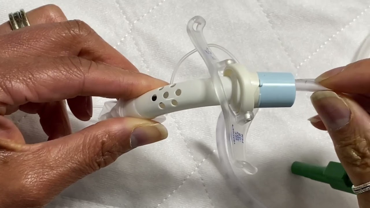 Tracoe tracheostomy tube w/ inner cannula