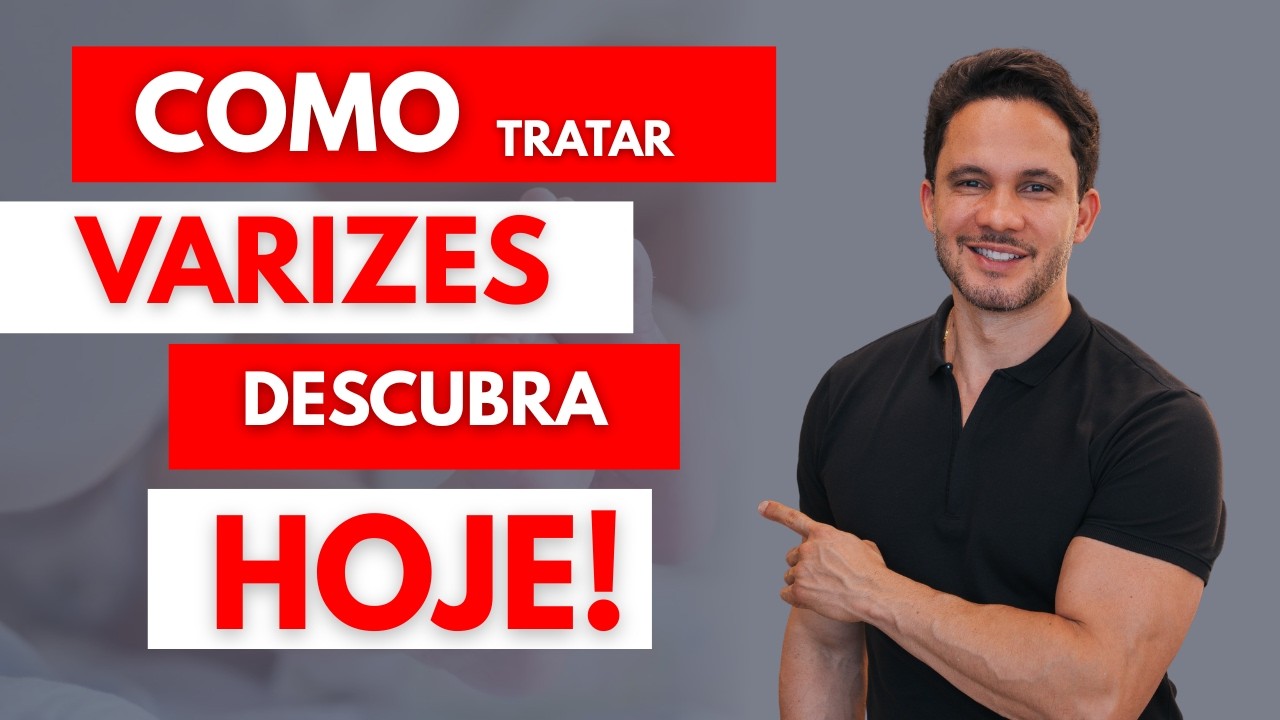 COMO tratar suas VARIZES HOJE! Veja e tire suas DÚVIDAS!