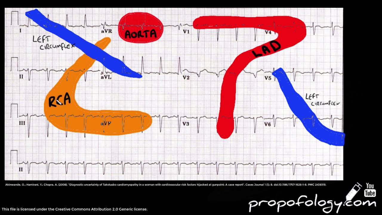 ECG Territories in 2 minutes