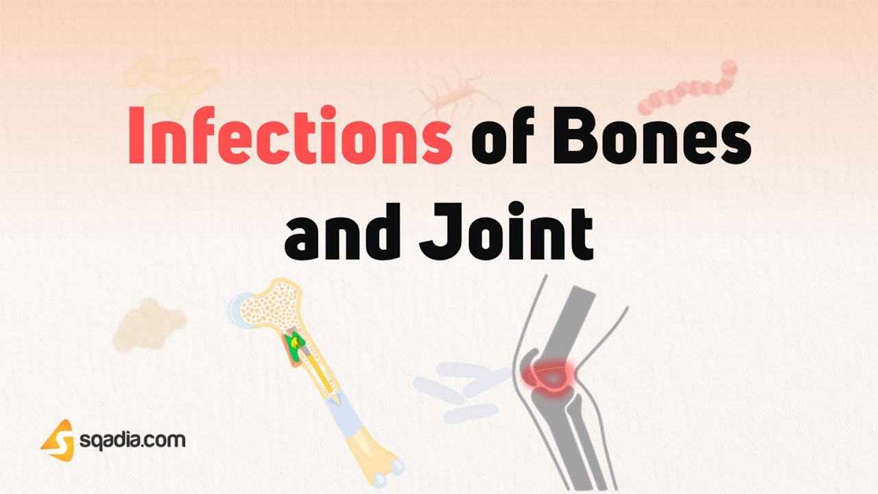 Infections of Bones and Joints - Introduction
