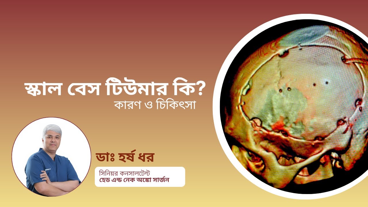 স্কাল-বেস টিউমার | কেন প্রাথমিক নির্ণয় জরুরি | Skull-Base Tumour Explained | Dr. Harsh Dhar