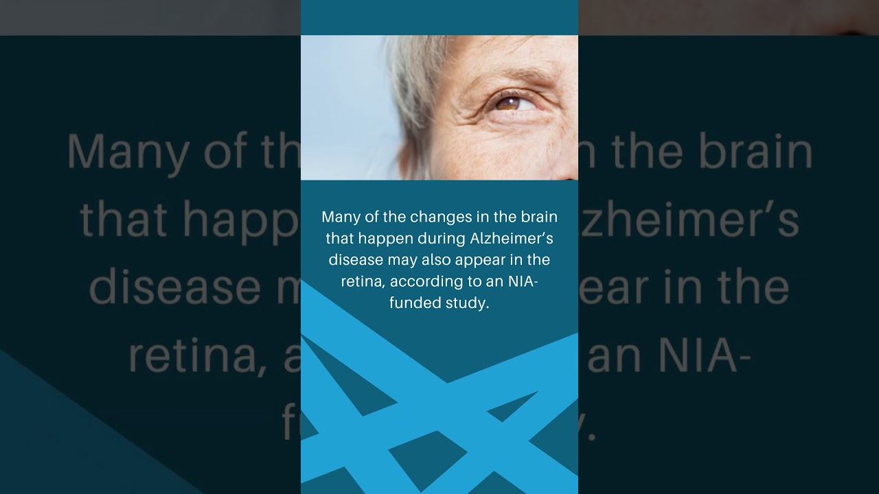 #nia #research #aging #guthealth #gutbrainaxis #brain #alzheimers #eyehealth  #vitamin  6/30/2023