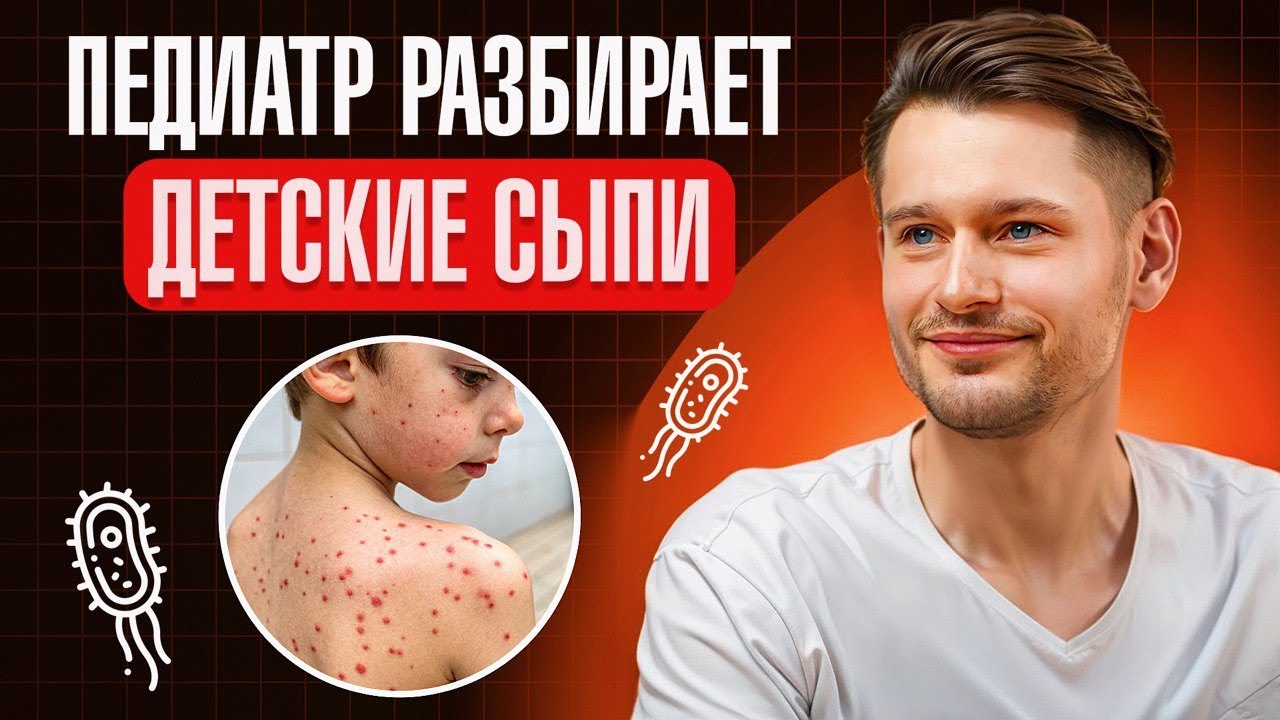 Сыпь у ребёнка: опасно или нет? Детские сыпи — как отличить и что делать? Объясняет педиатр