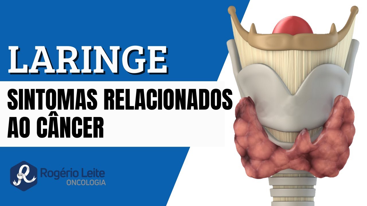 Você sabe quais os sintomas relacionados ao câncer de laringe?