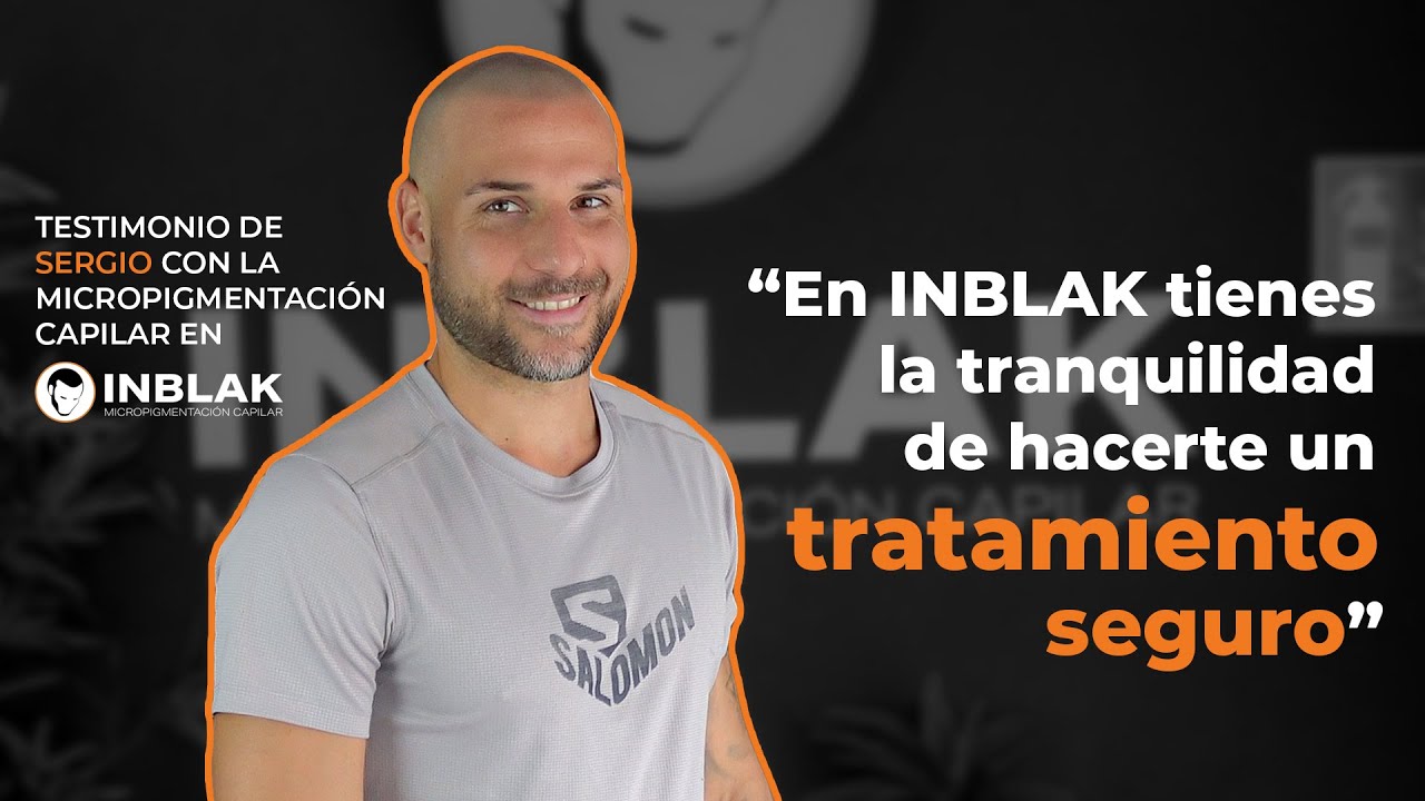 Sergio: Testimonio de micropigmentación capilar en INBLAK