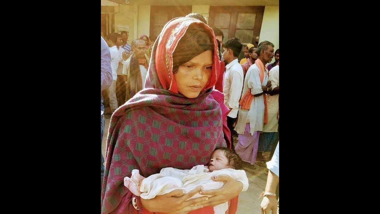 दरभंगा: DMCH में चूहे ने कुतरकर नवजात को मार डाला