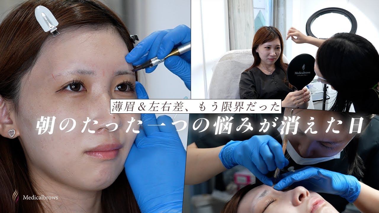 眉毛が薄すぎて毎朝つらい…左右非対称の悩みをアートメイクで解決！