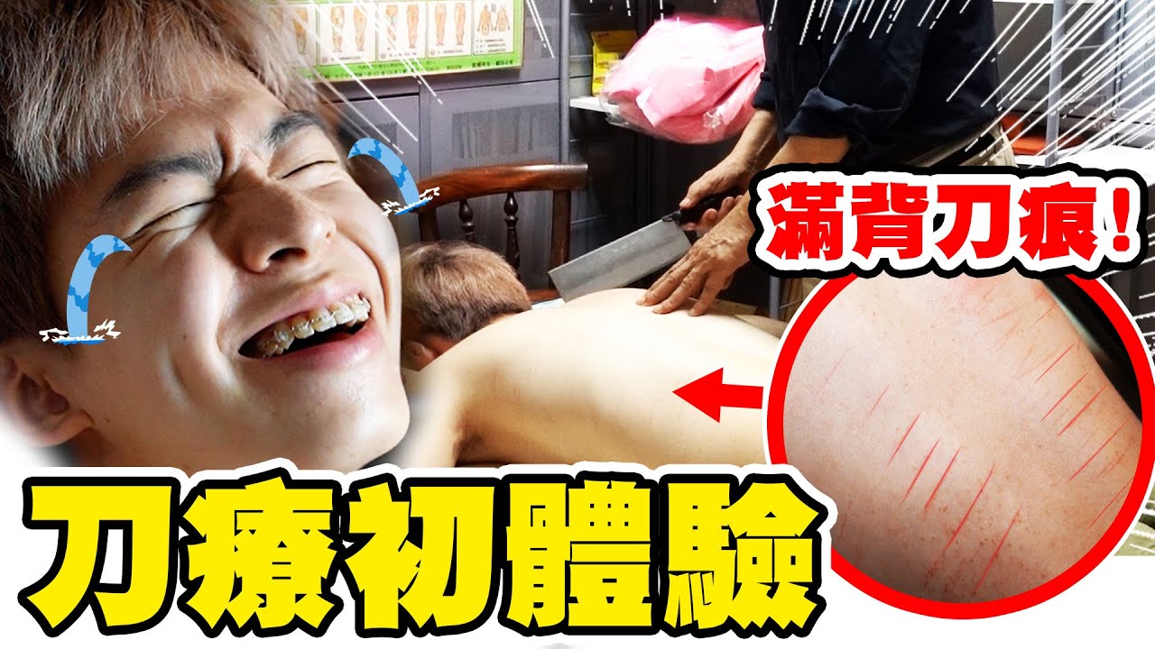 民俗療法「刀療」初體驗！背上滿滿刀痕，慘叫嚇爆眾人【黃氏兄弟】