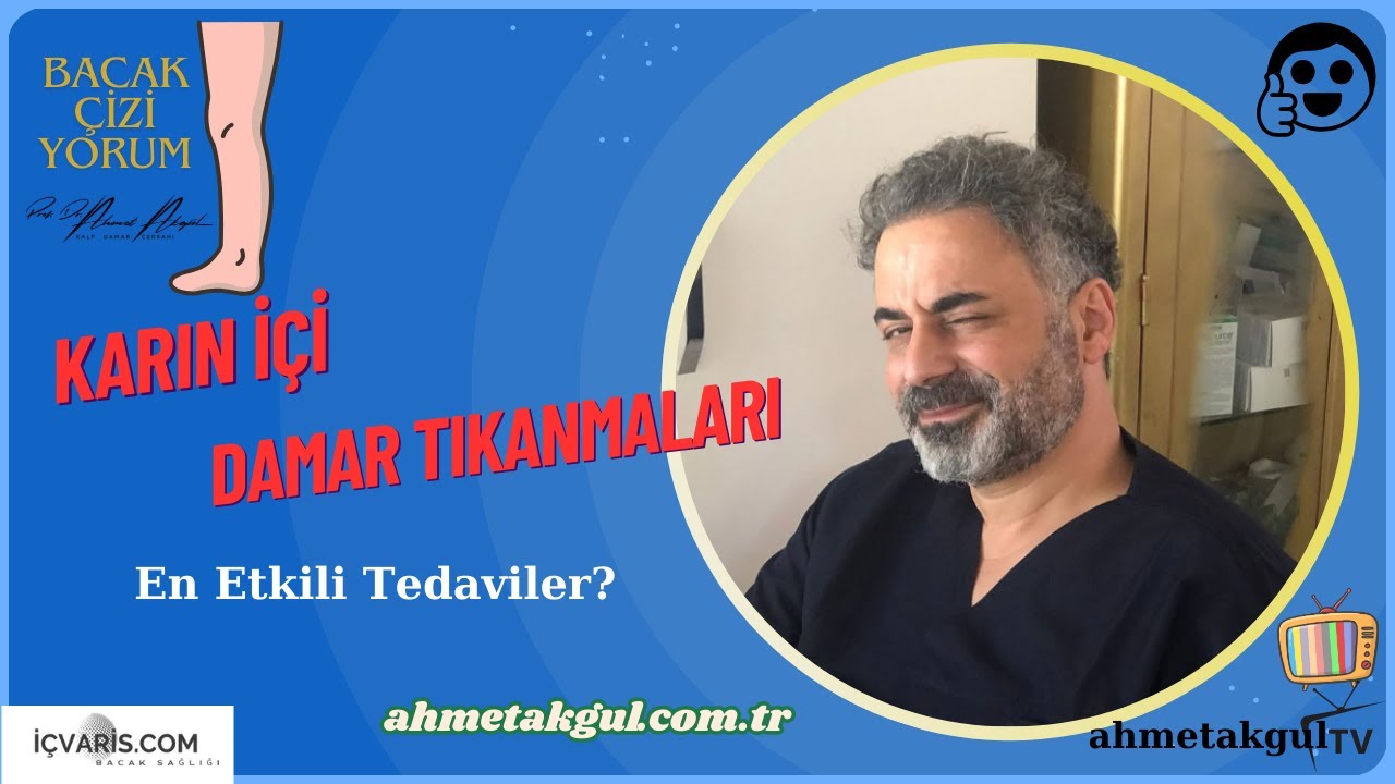 Bağırsakları Besleyen Damarın Tıkanması (Mesenterik İskemik) - Prof. Dr. Ahmet AKGUL