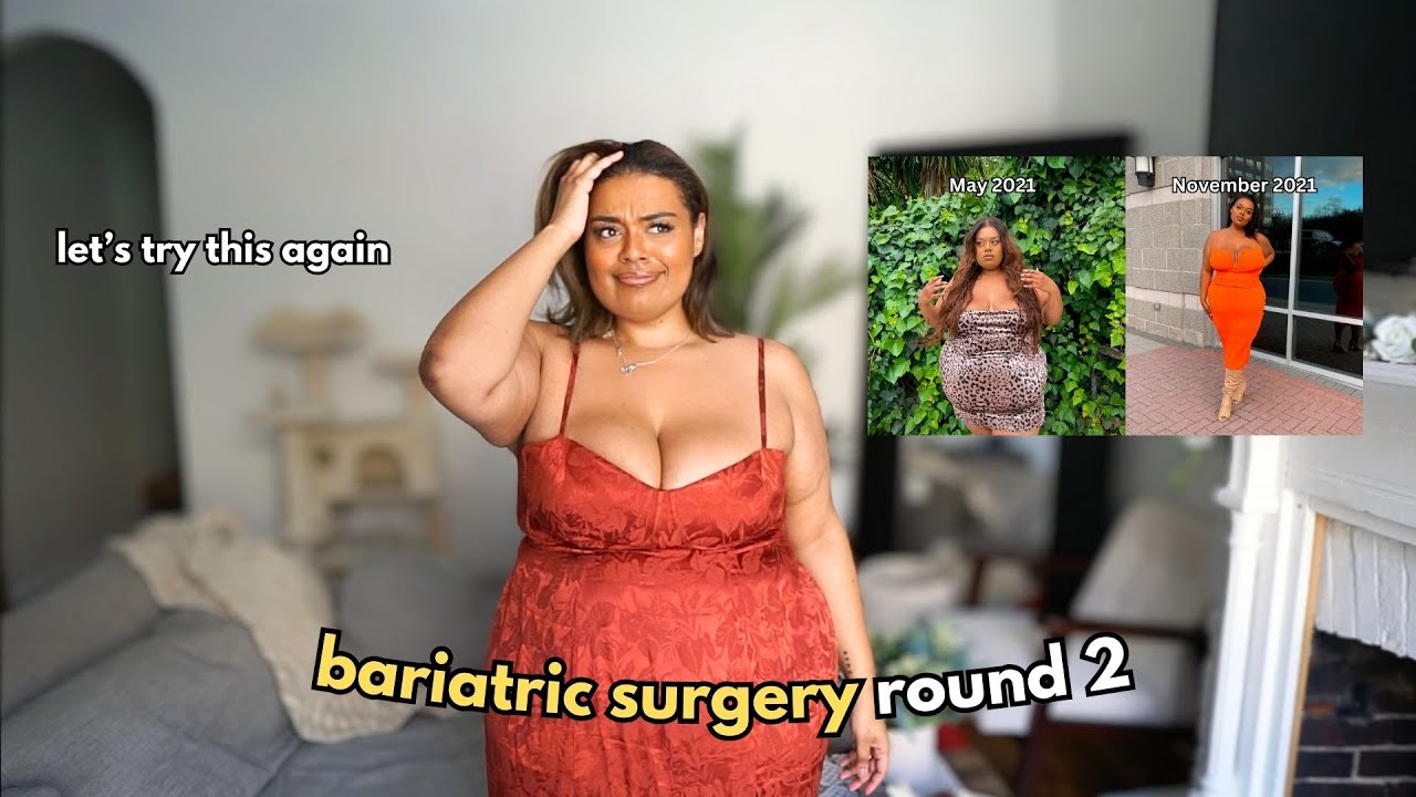 weight loss surgery...again (VSG Journey)