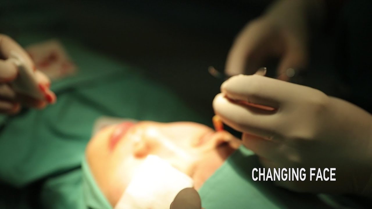 Changing Face: China’s cosmetic surgery industry