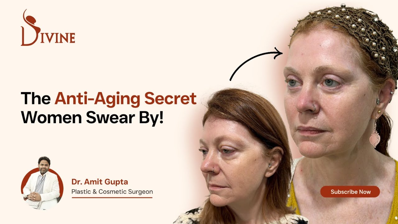 Best Non-Surgical Facelift for Anti-Aging | Infinite Thread Lift Explained