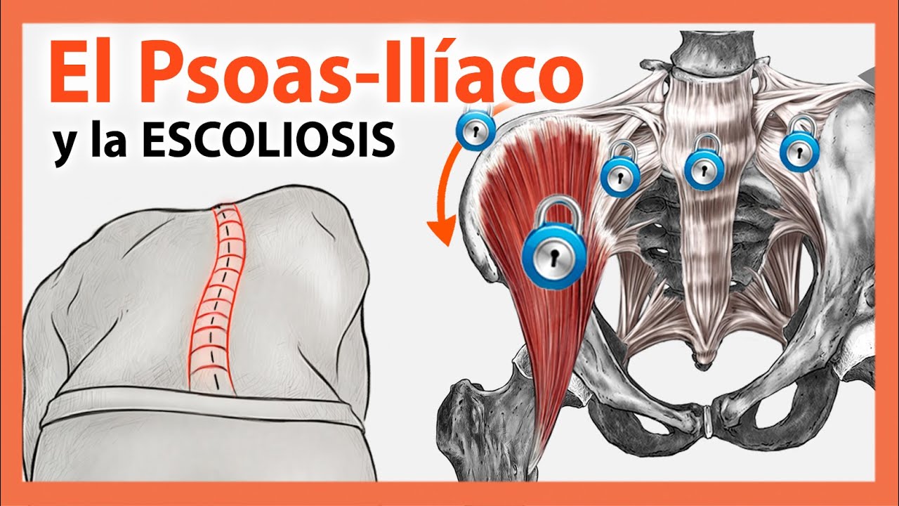 🔴 Psoas Ilíaco y la Escoliosis 👉 EJERCICIOS para la Pelvis y la Columna Lumbar