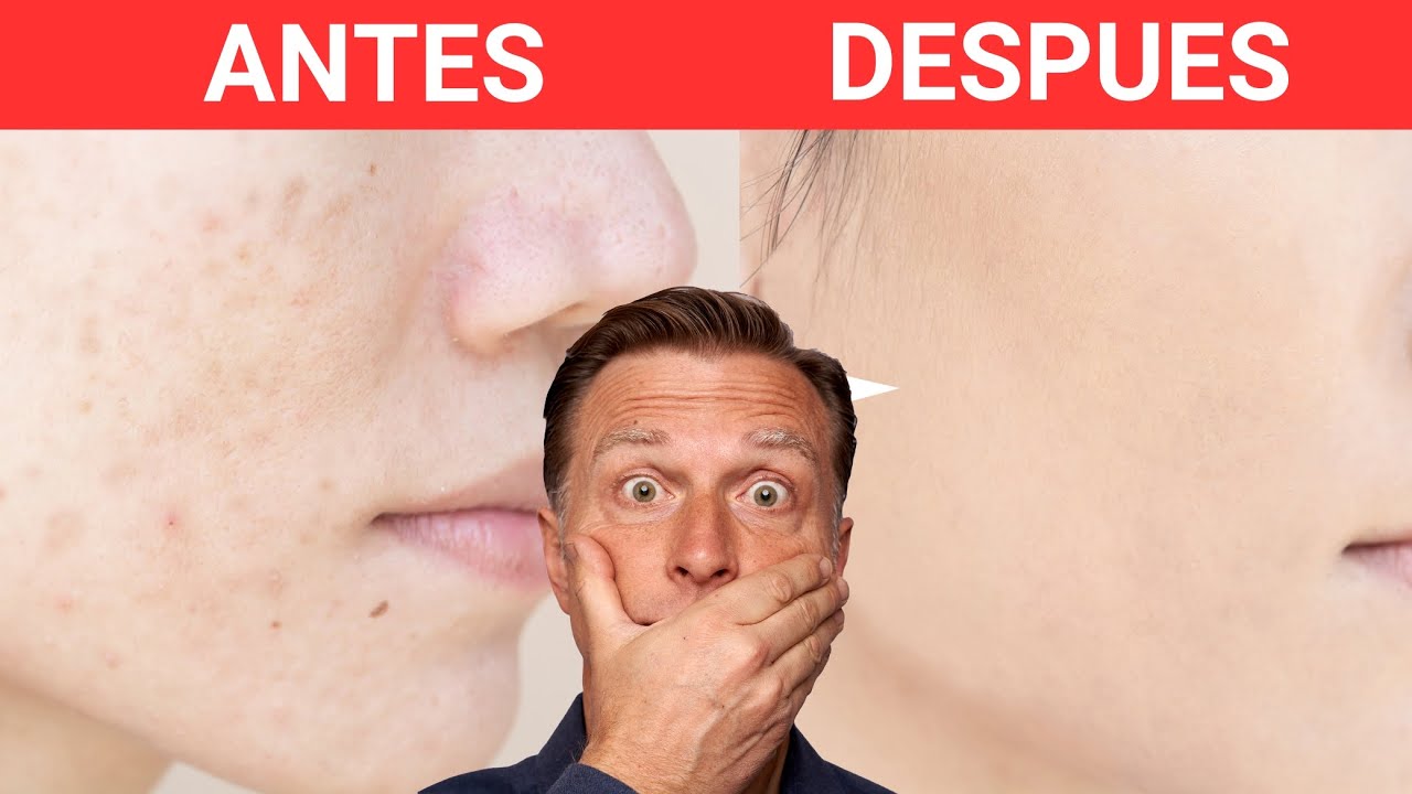 El 1 mejor probiótico para enfermedades autoinmunes