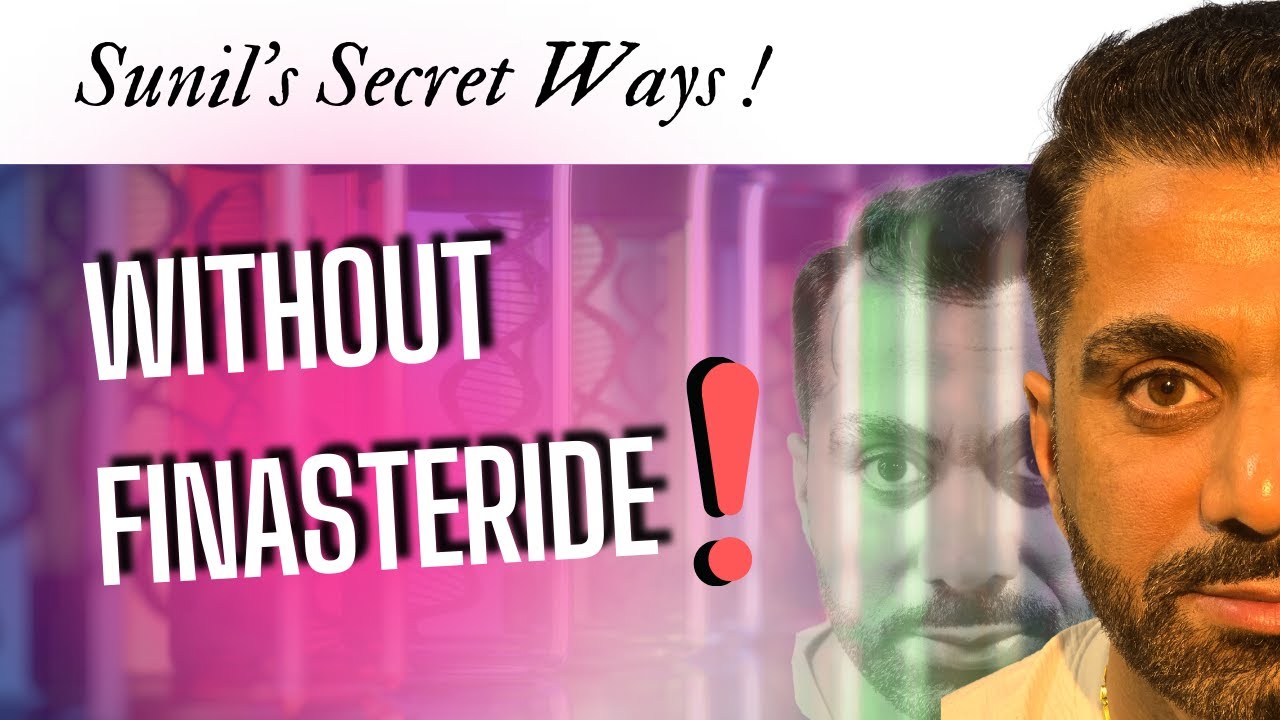Hair Transplant in India without Finasteride !