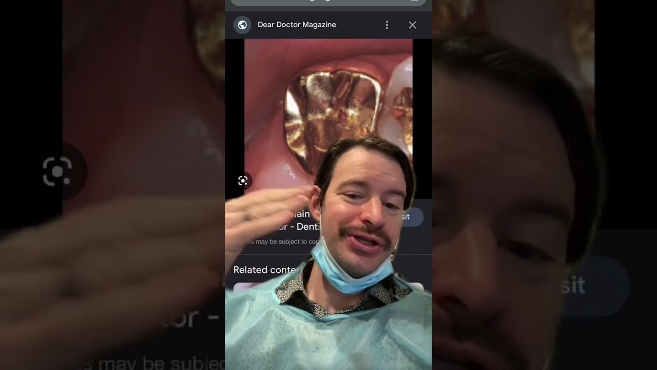 Gold Dental Crowns are Pretty Cool