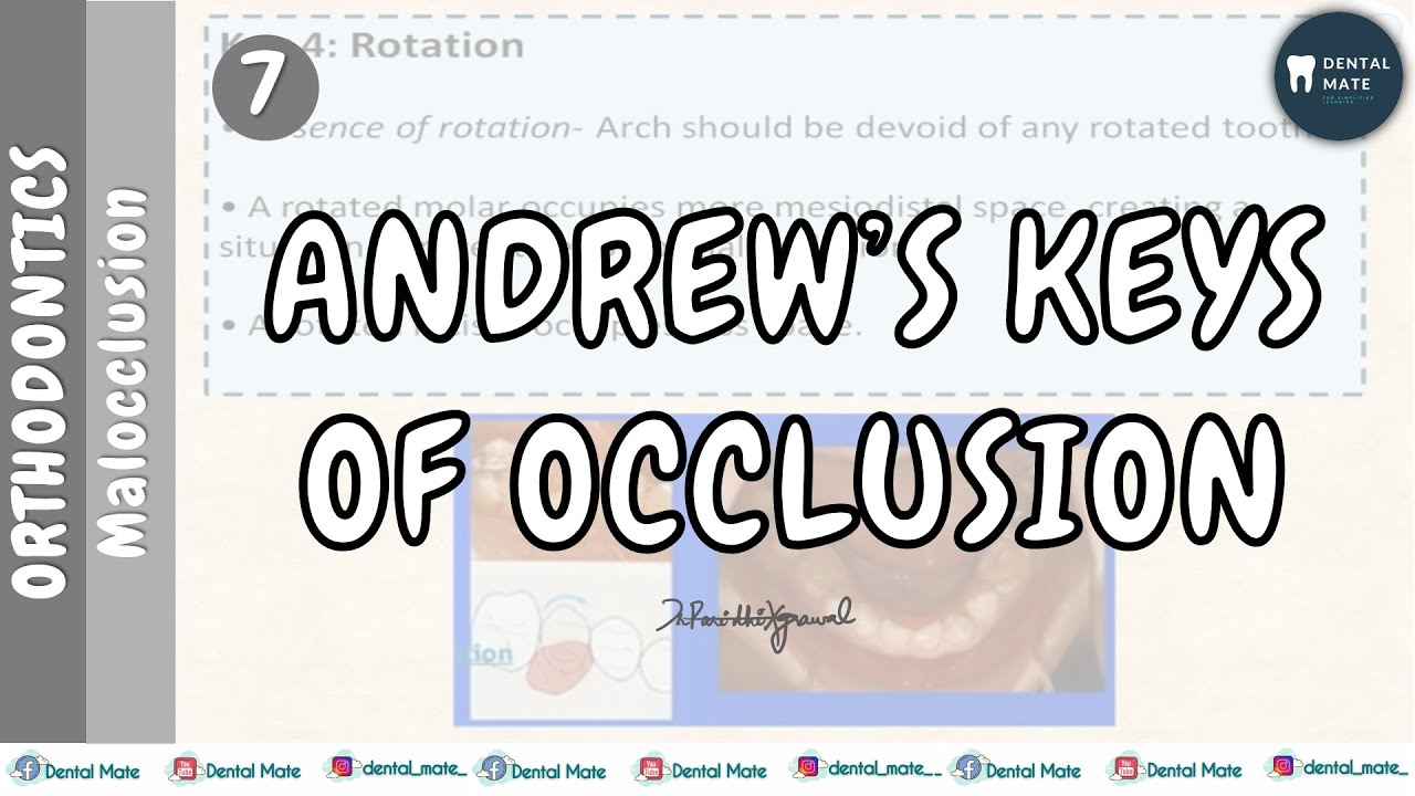 Andrew's keys of static occlusion | Dr Paridhi Agrawal