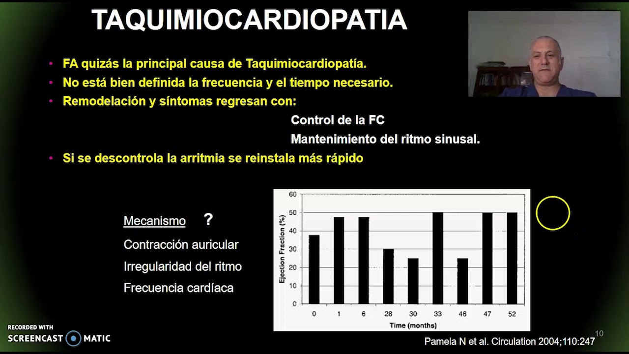Seminario Fibrilación Auricular por Dr. Alejandro Cuesta