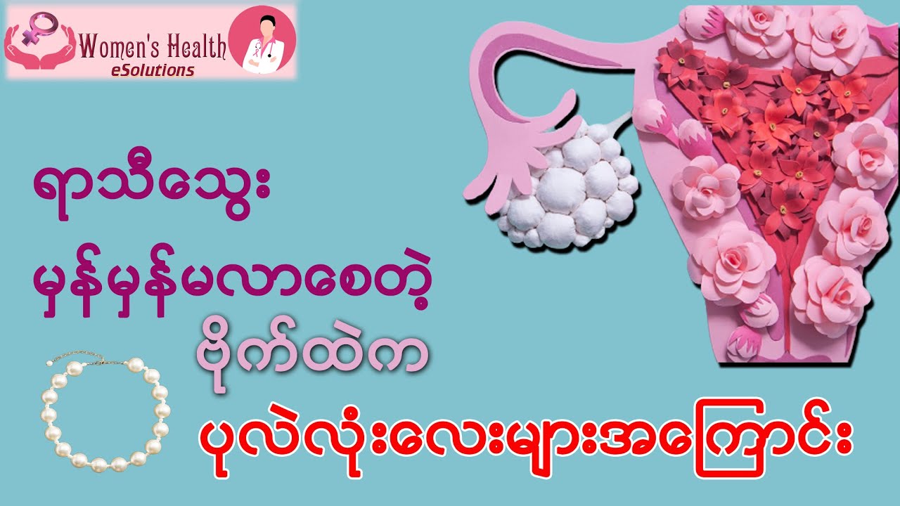 ရာသီသွေး မှန်မှန်မလာစေတဲ့ ဗိုက်ထဲက ပုလဲလုံးလေးများအကြောင်း - Polycystic Ovarian Syndrome