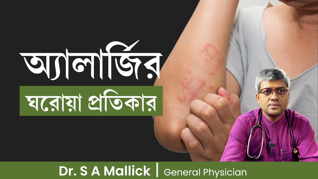অ্যালার্জির ঘরোয়া প্রতিকার কি? Home Remedies of Allergy | Dr. S A Mallick