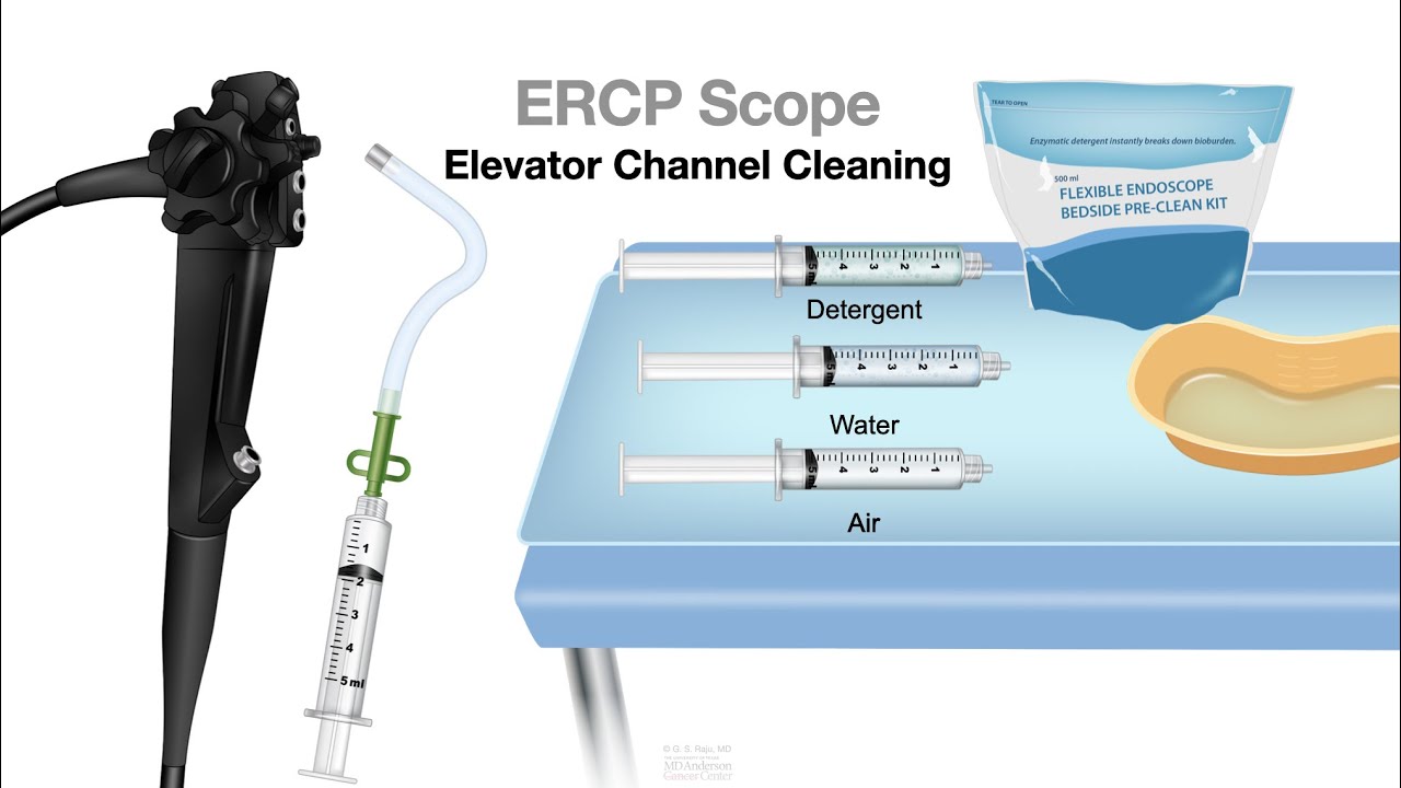 HCC 1474-9a ERCP scope reprocessing
