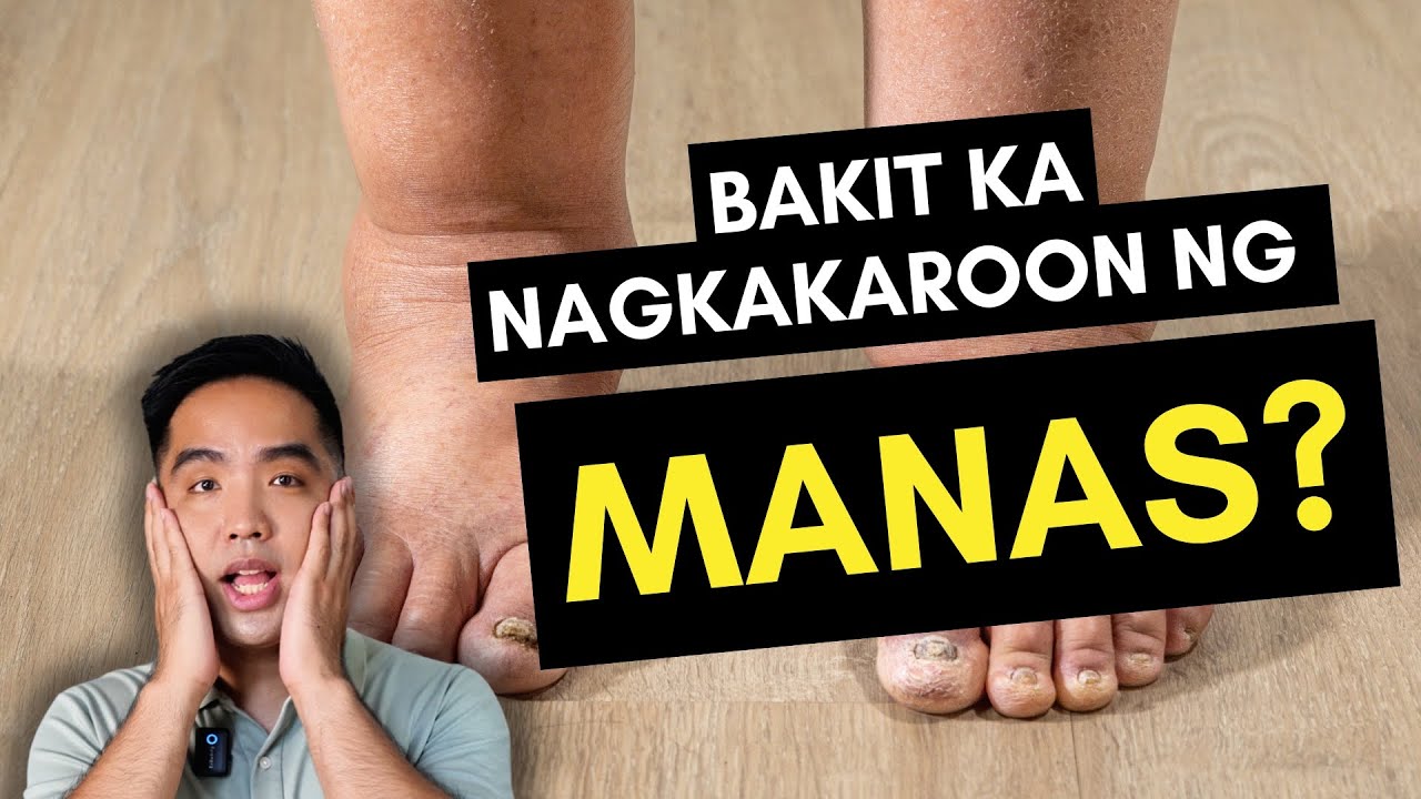 Bakit Nagkakaroon ng Manas?