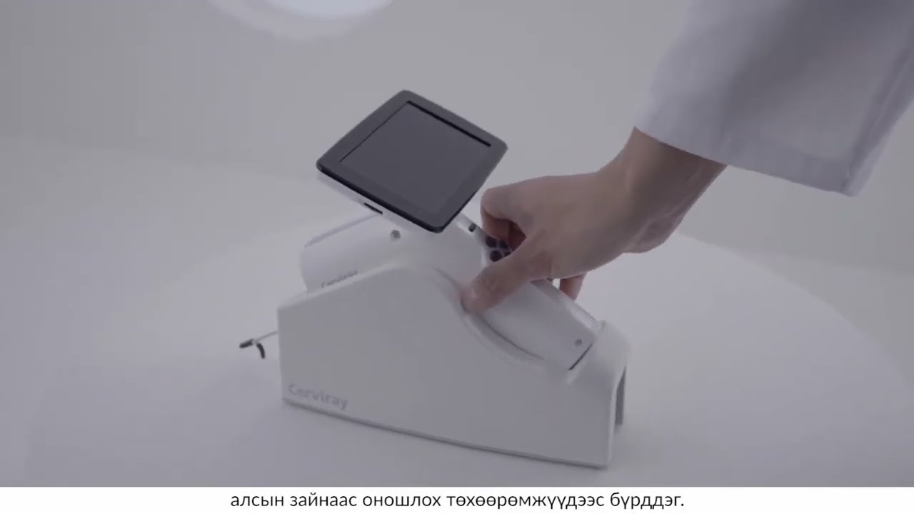 Cerviray Ai - Умайн хүзүүний хавдрын оношилгооны ухаалаг шийдэл - IT laboratory