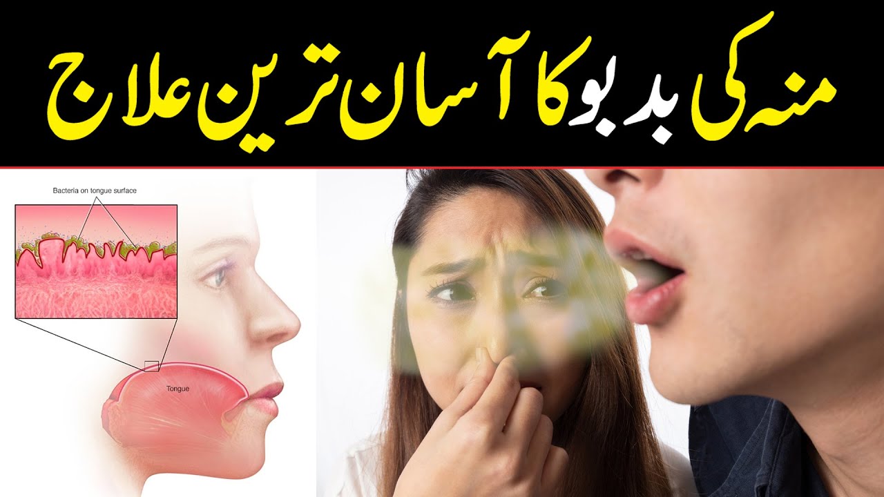 What Causes Bad Breath? Diagnosis and treatment | Munh ki Badboo ka Asan Ilaj