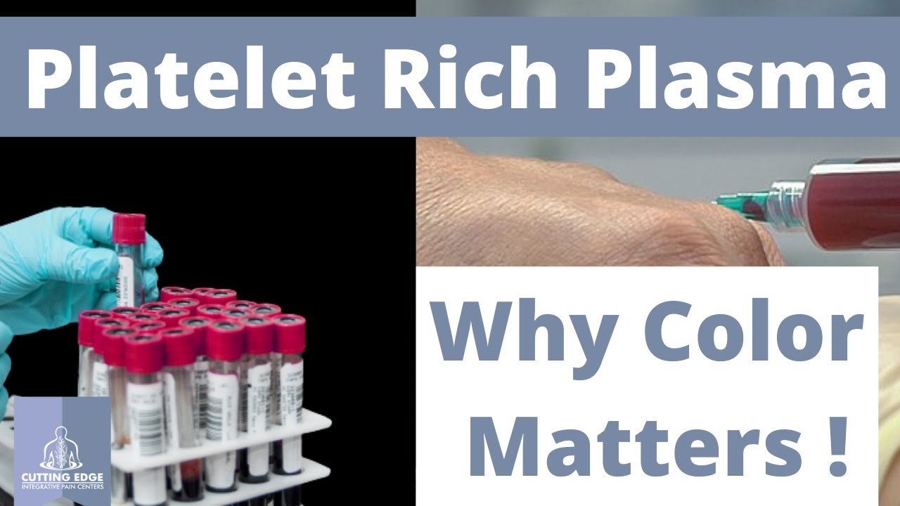 Why The Color of PRP Can Affect Whether You Get Better !