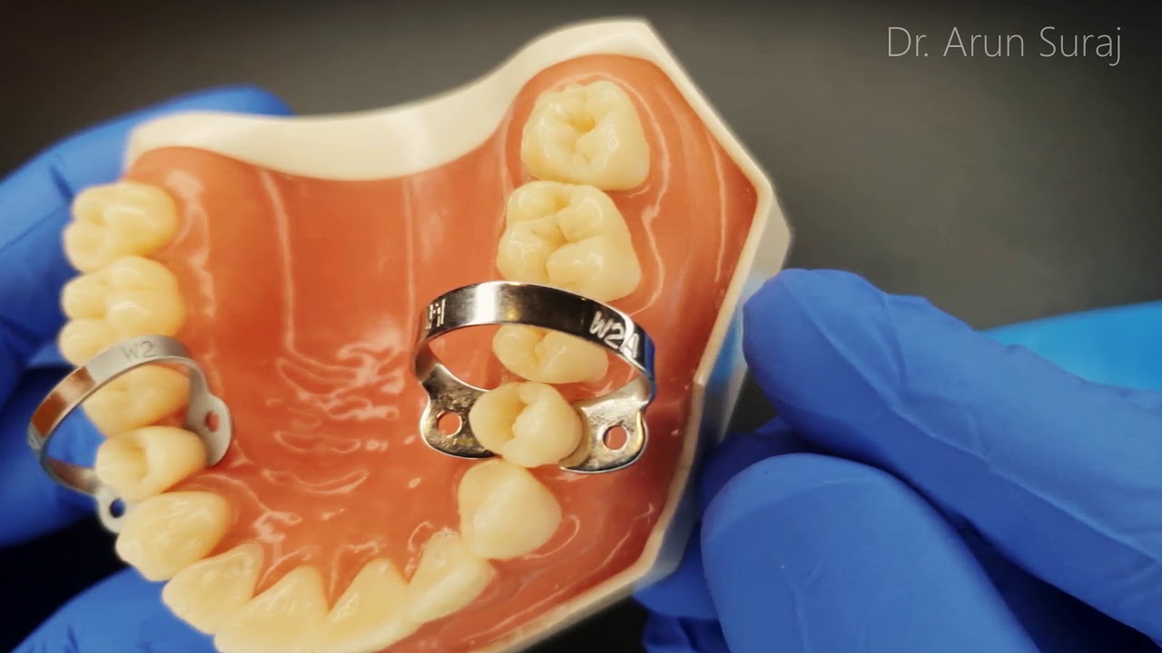 Rubberdam isolation for anterior teeth.