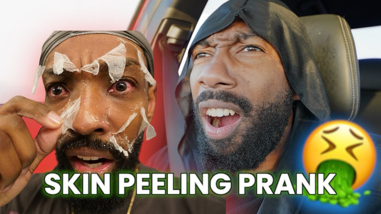 DISGUSTING SKIN PEELING PRANK ON MY BROTHER! | VLOGMAS DAY 11