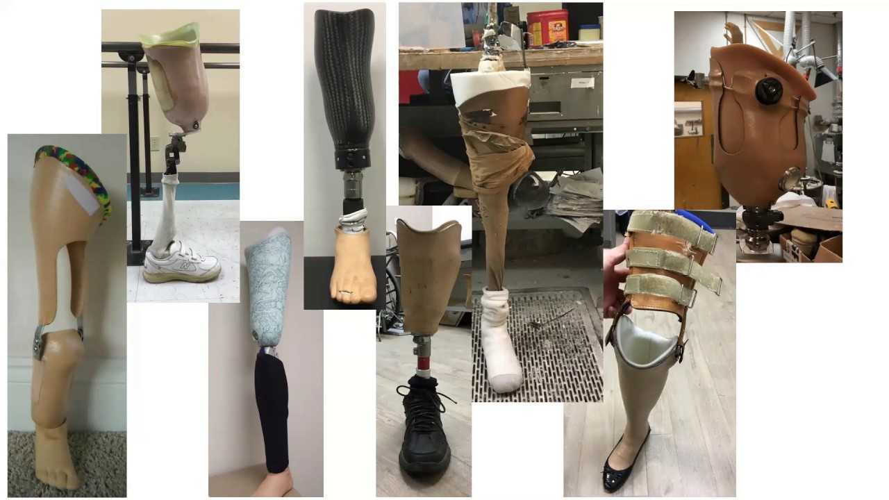 WEBINAR: ST&G Material Selection for Prosthetic Socket