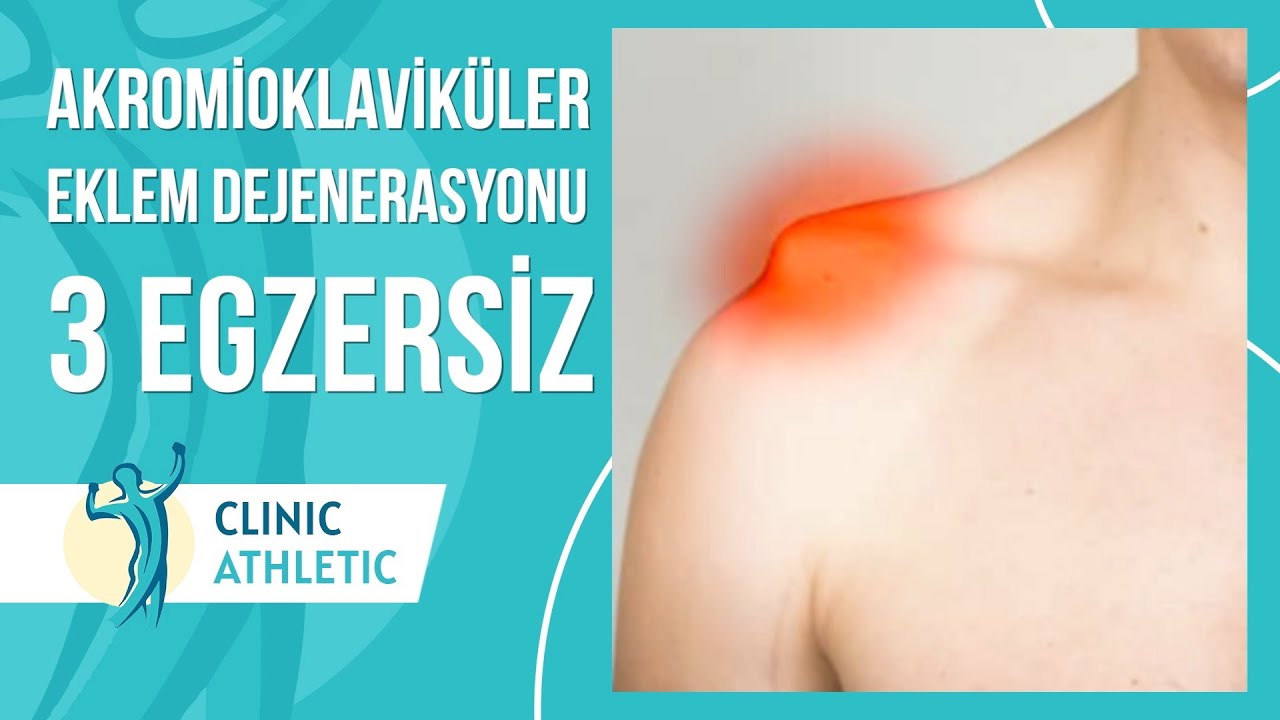 Akromioklaviküler Eklem Dejenerasyonu Nedir? 3 Basit Egzersiz!