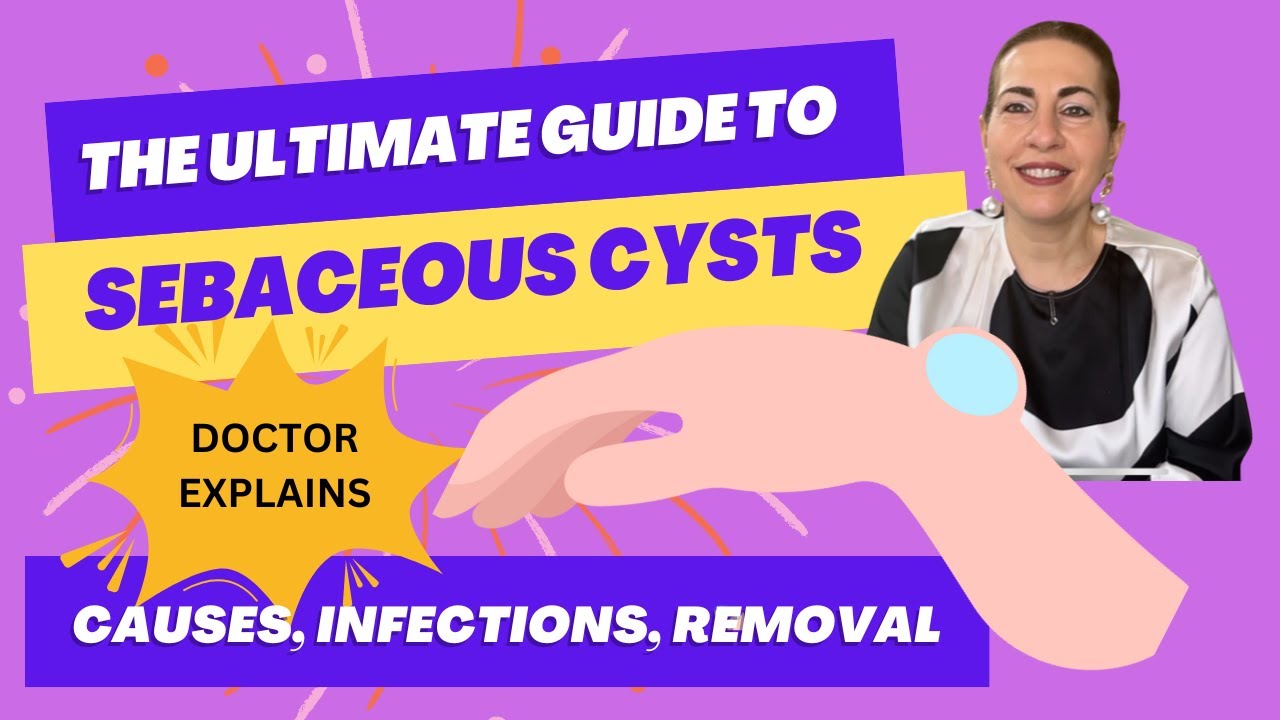 The ULTIMATE Guide to Sebaceous Cysts: Causes, Infections, Removal - Doctor Explains