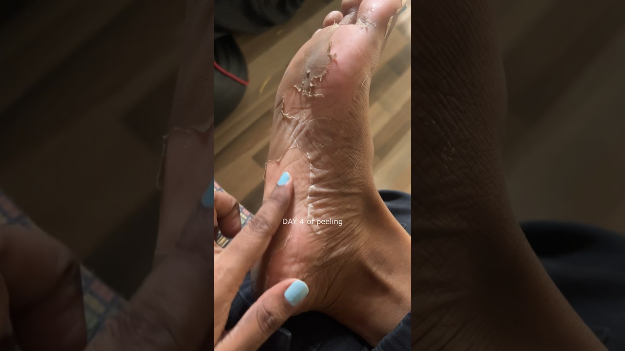 Tried the viral FOOT PEELING MASK🤯 Have you tried it??👀 #shorts #harinisi #skin