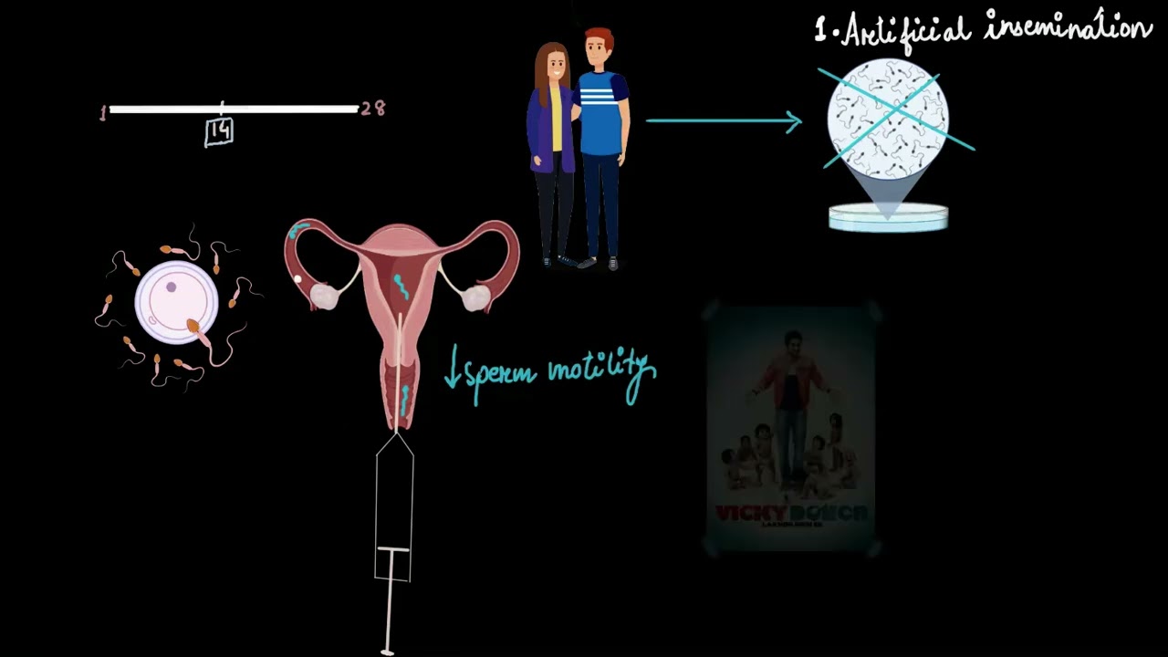 Artificial insemination and GIFT | Reproductive health | Biology | Khan Academy