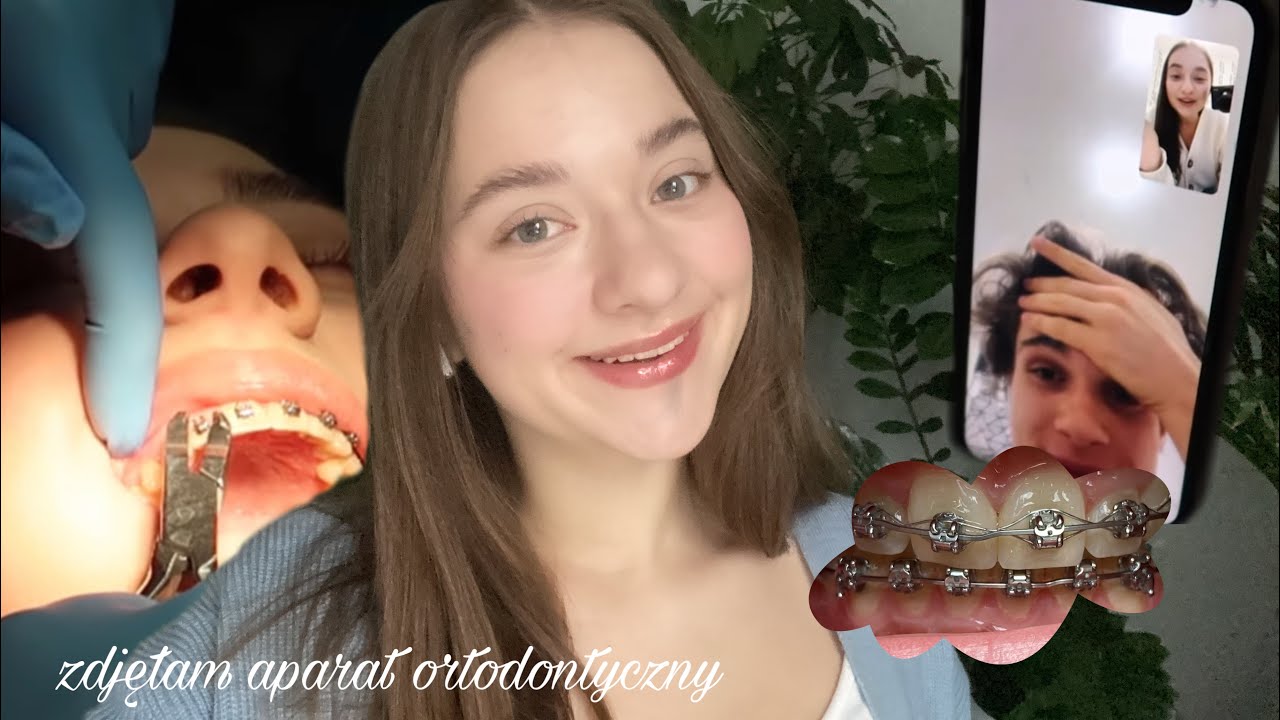 ŚCIĄGNEŁAM APARAT ORTODONTYCZNY!
