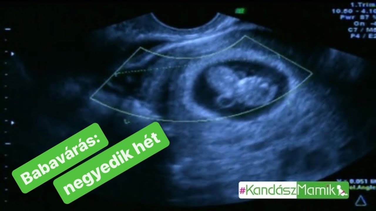Babavárás 3. rész Az a bizonyos varázslatos negyedik hét.