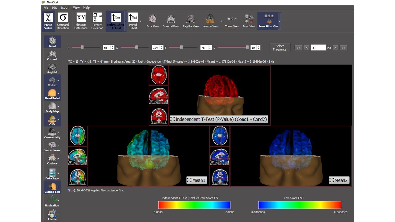Navistat Introduction - EEG NeuroImaging Statistics