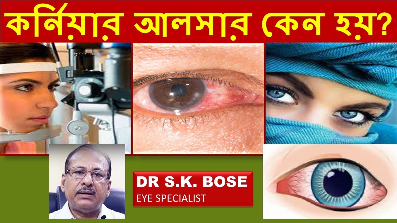 কর্নিয়ার আলসার কেন হয়? #CORNEALULCER #eyehealth  REASON BEHIND CORNEAL ULCER |  । DR. S K BOSE