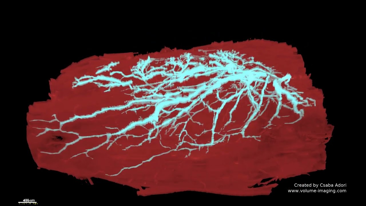3D volume imaging - CHOLINERGIC NERVES IN THE MUSCLE MOVIE 1
